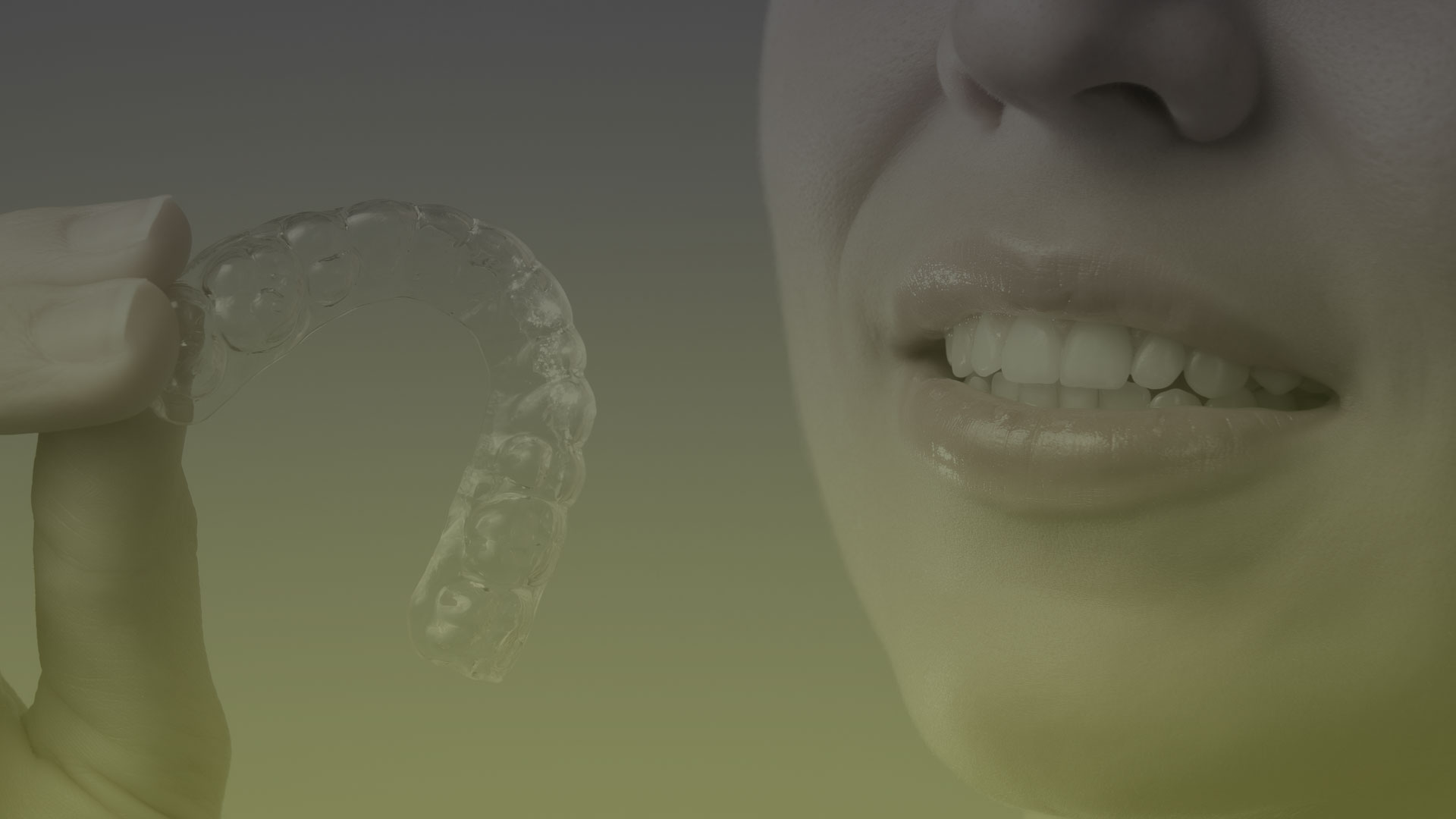 Invisalign Braces in Toronto