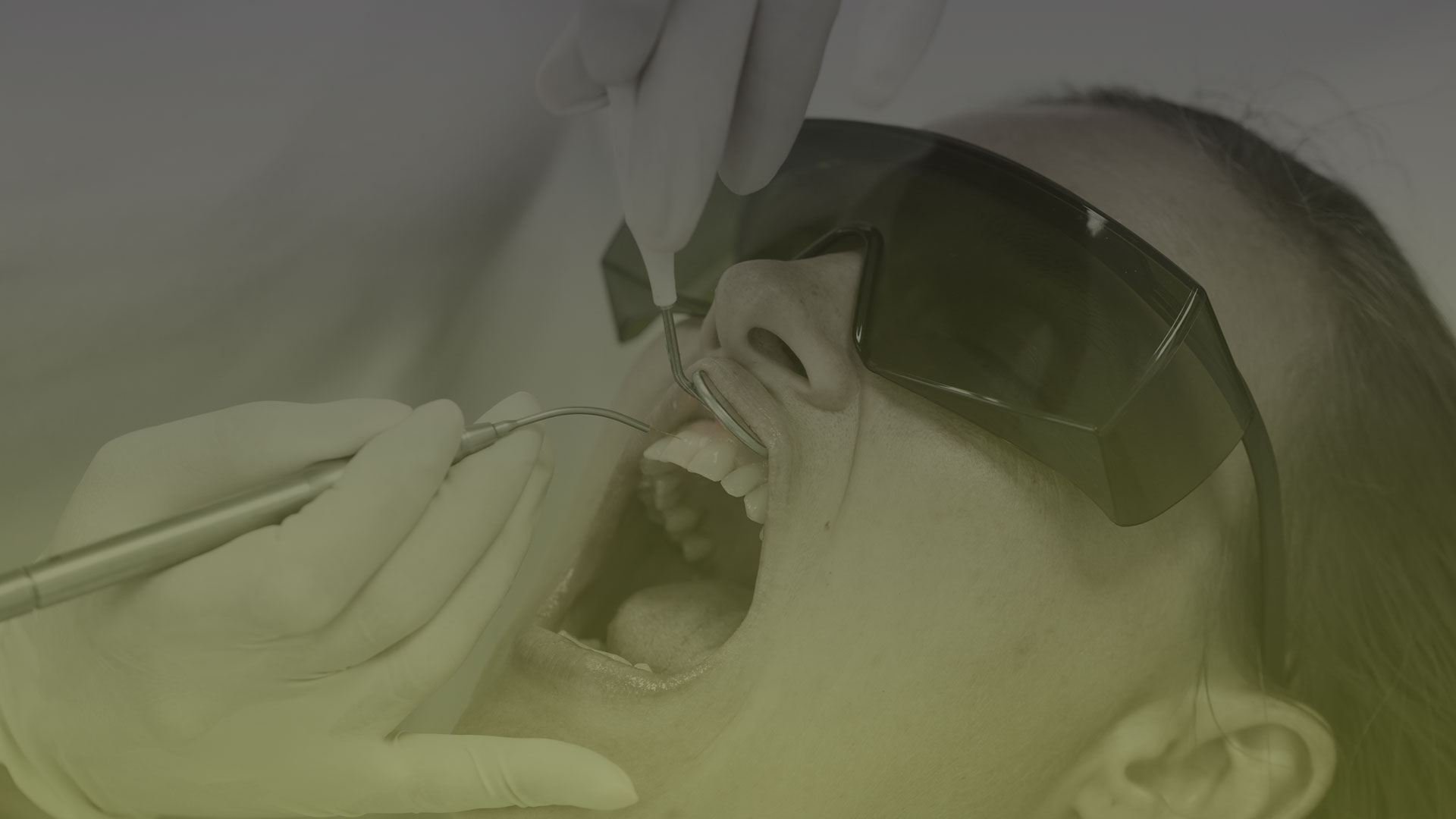 Laser Gum Disease Treatment in Toronto