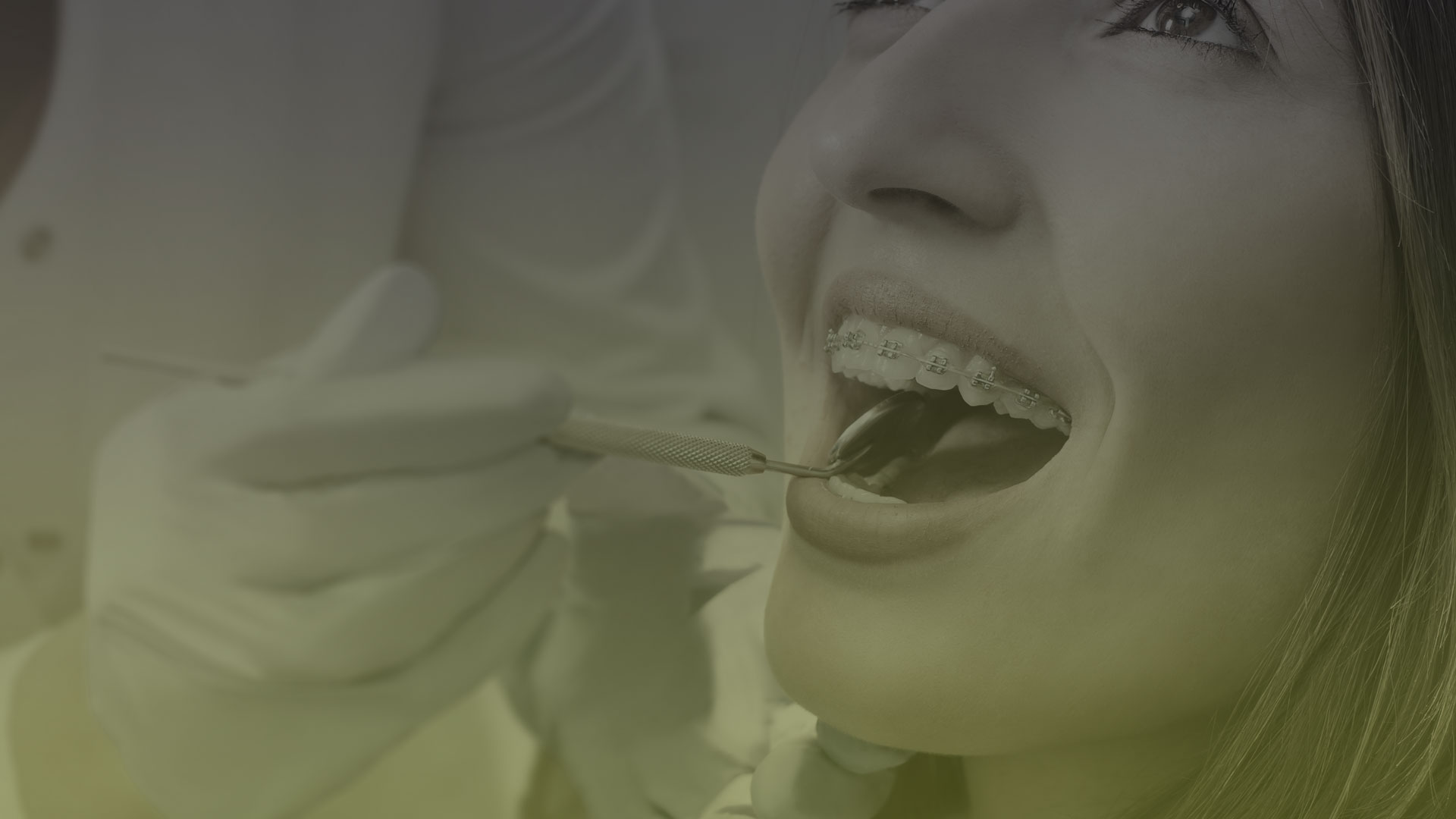 Dental Braces in Toronto