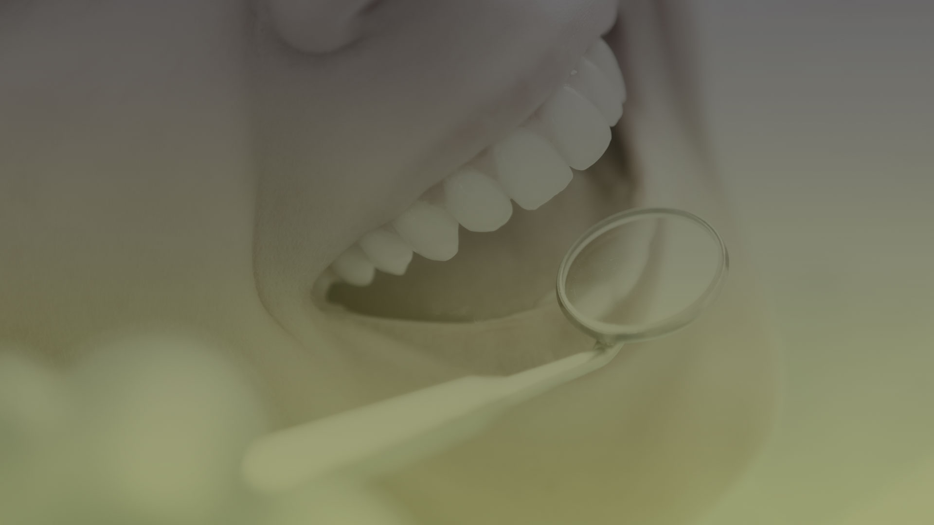Prophylaxis Tooth Cleaning in Toronto