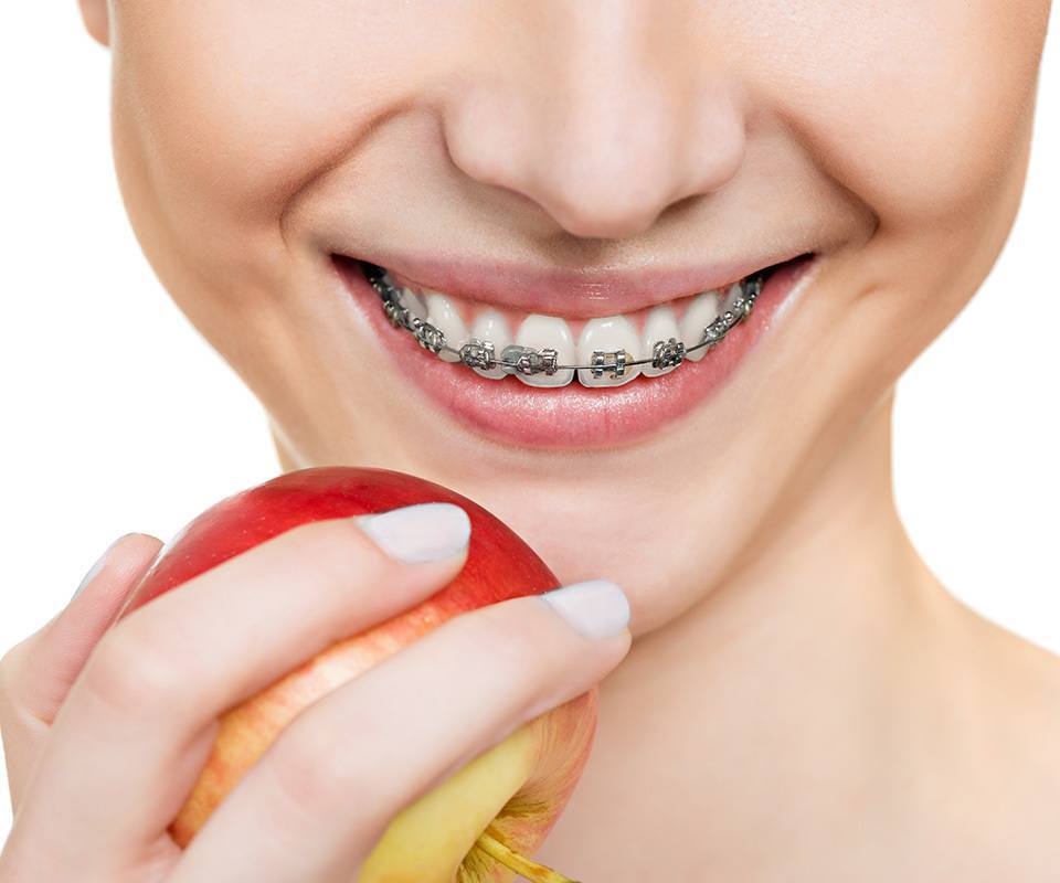Orthodontics 1